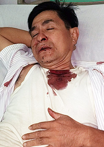 Pastor Quang suffered broken ribs, a broken nose and numerous other injuries when he and an associate pastor were attacked on Jan. 18 in southern Vietnam.