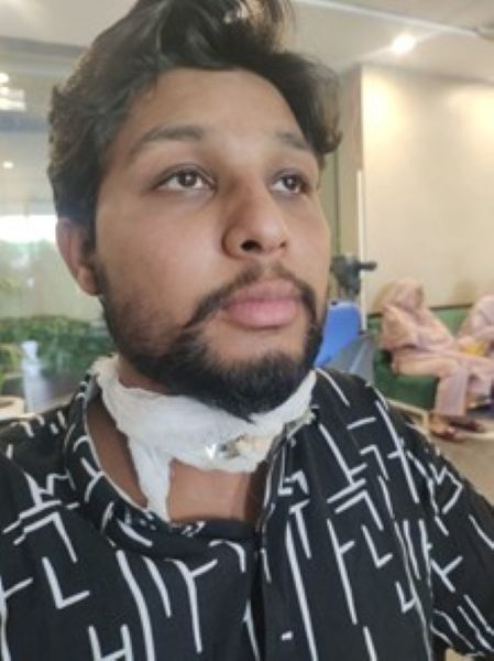 Waqas has had two throat surgeries and remains hospitalized.