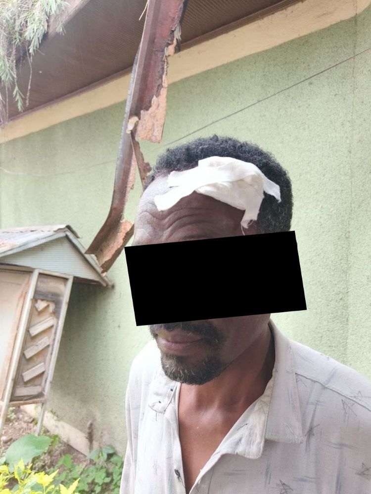 This Christian was injured in an Islamist attack on an Ethiopian church.