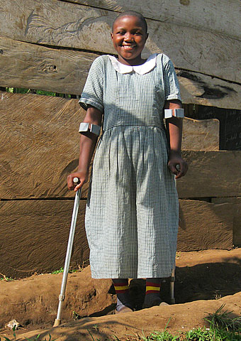 After multiple surgeries, Susan is now able to walk again with assistance.