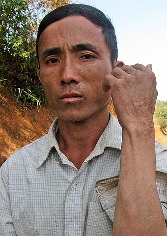 "Tuyen" and a fellow believer suffered injuries after they were both tied up and beaten for their faith and are no longer welcome in their village.