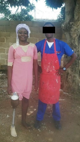 Evelyn, a Christian from Nigeria, is shown with her new prostethetic leg.