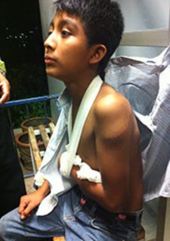 Eugenia's son was also injured in an attack where she was seriously injured by a man attempting to kill her for sharing the gospel in Chiapas, Mexico.