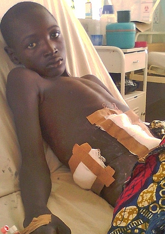 A young boy who was injured in another recent attack by Boko Haram