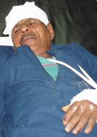 An Egyptian man is receiving medical care after being attacked for his faith.