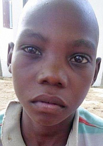 Gabriel Stephen survived a gunshot wound to his hip when his village in Nigeria was attacked by Boko Haram militants in February 2014.